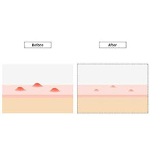 Load image into Gallery viewer, Dr.G R.E.D Blemish Clear Soothing Spot Balm 30ml