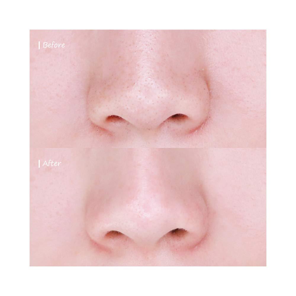 CNP Anti-Pore Blackhead Kit-Strip 3pc Set I Gentle Nose Strips I Pore Care, Dead Skin Cell Remover, Korean Skincare