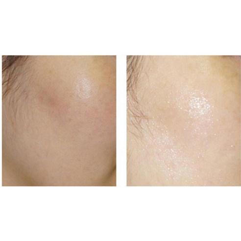 [all NATURAL] Organic Mask Sheet Houttuynia Cordata 25ml x 5ea